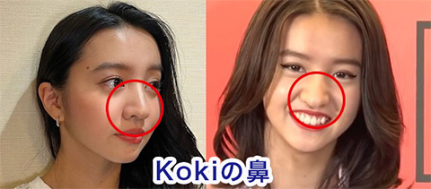 Kokiの鼻が大きい写真