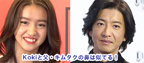 Kokiさんと父・木村拓哉さんの鼻を比較