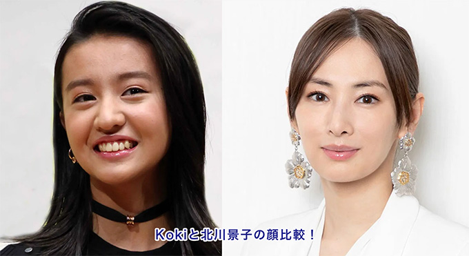 Kokiと北川景子さんの顔比較